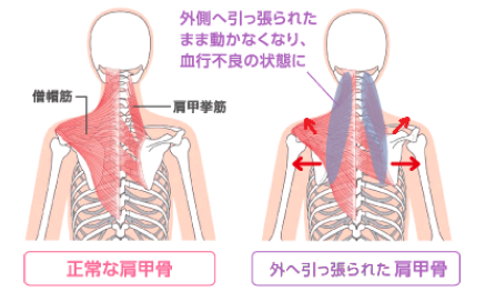 図解 これならきっと続けられる 肩こり さよならストレッチ スマイルボディ 整体 ヨガサロン青葉台