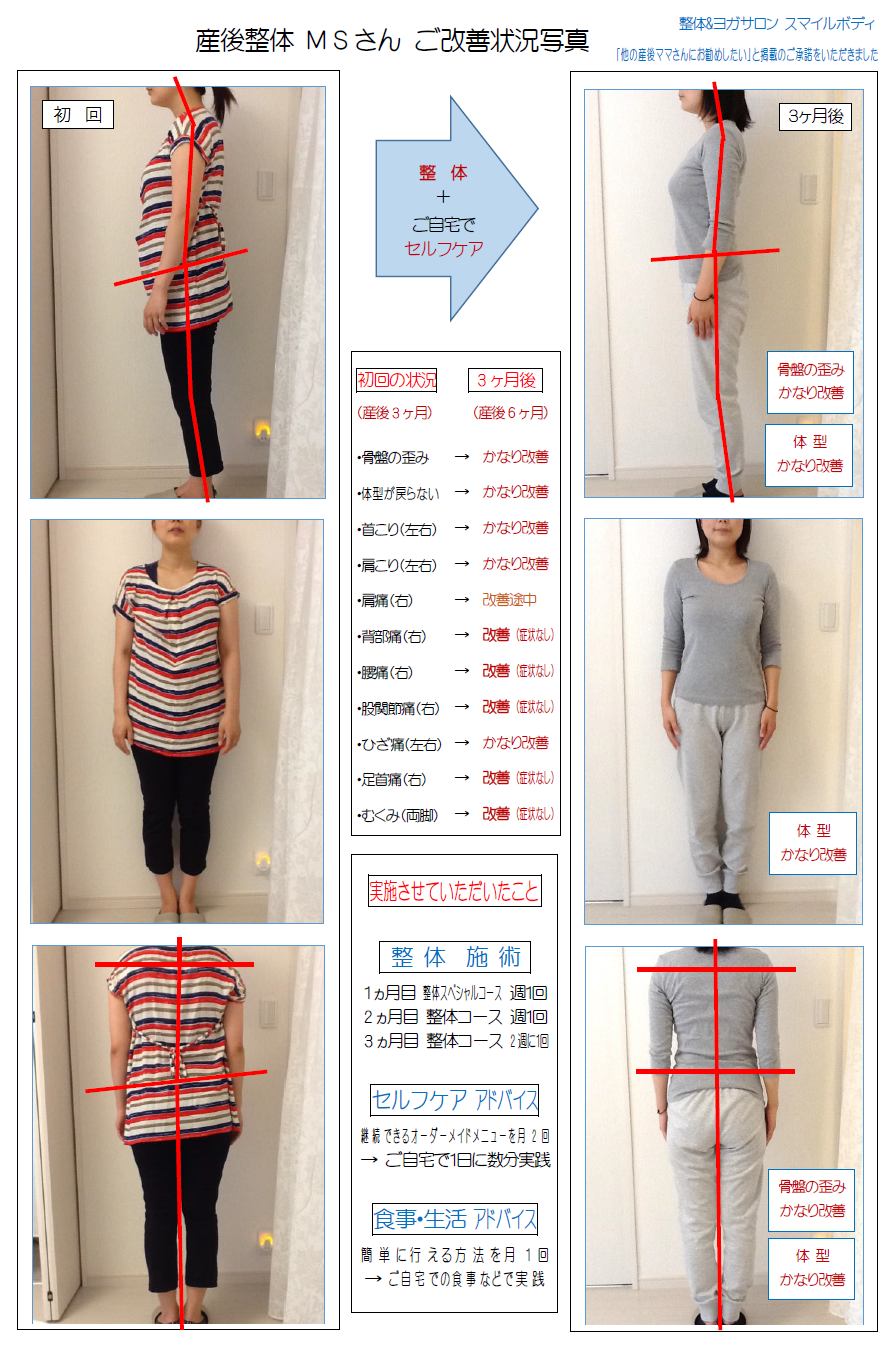 産後整体MSさん