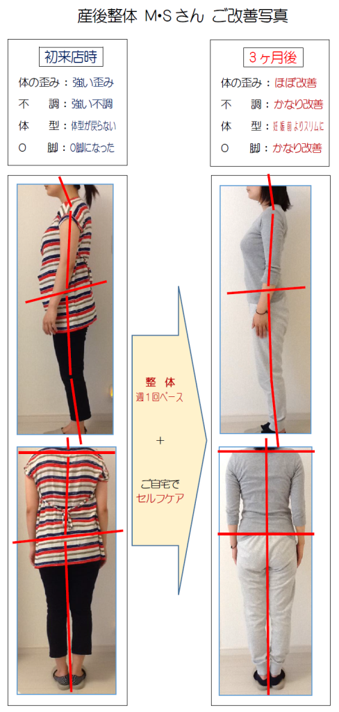 産後整体MSさん-新