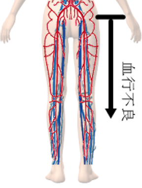 hie-1